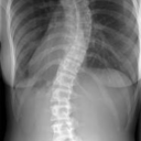 scooliosis-spines avatar